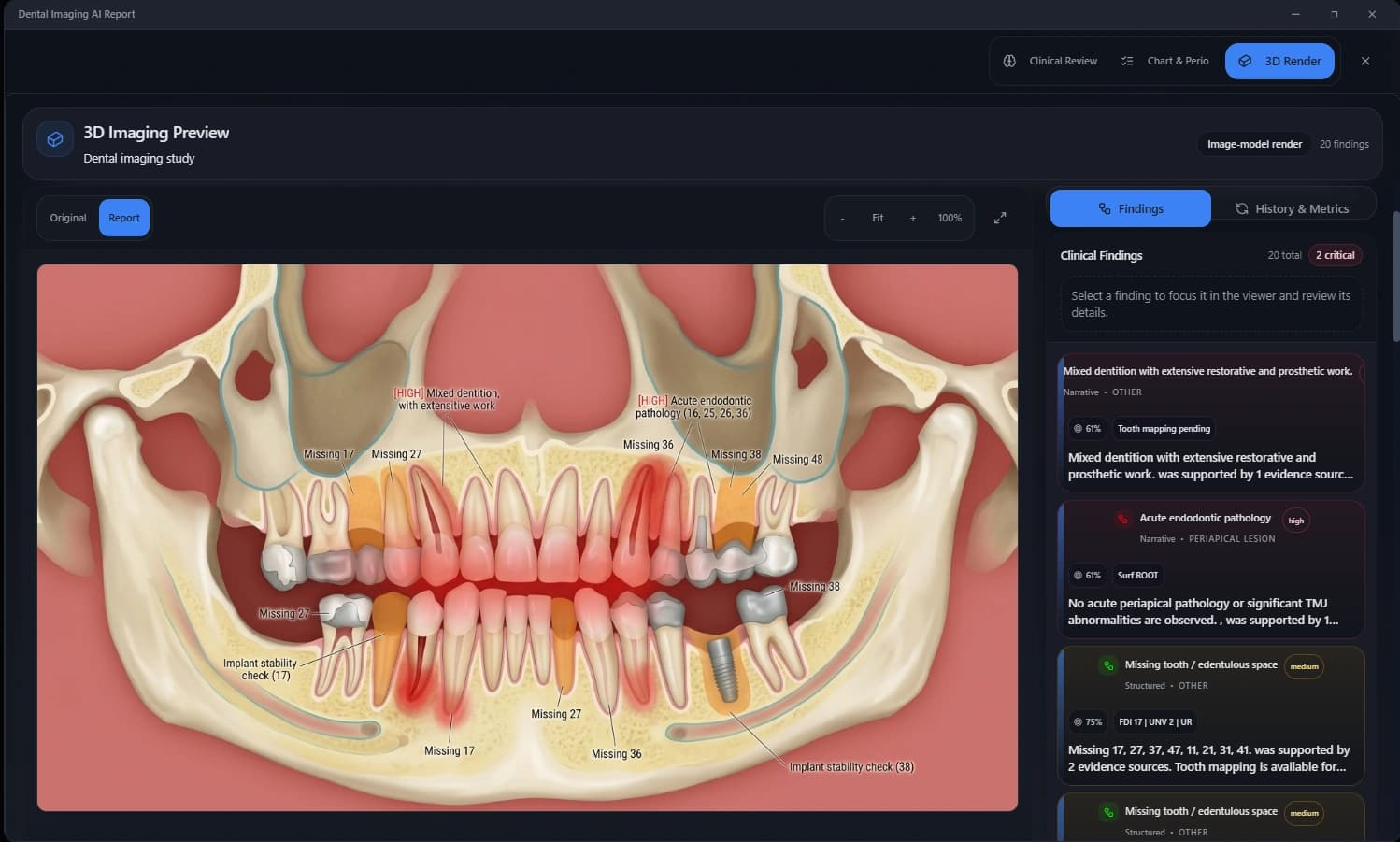 Per-surface odontogram with full restorative history